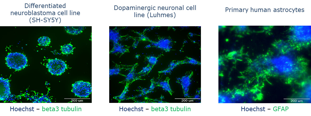 BIOMIMESYS® Microenvironment of Brain Tissue